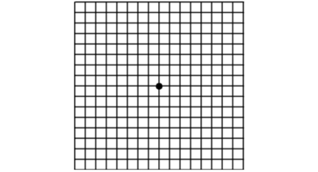 grille d'AMSLER utilisée pour le diagnostic de la DMLA