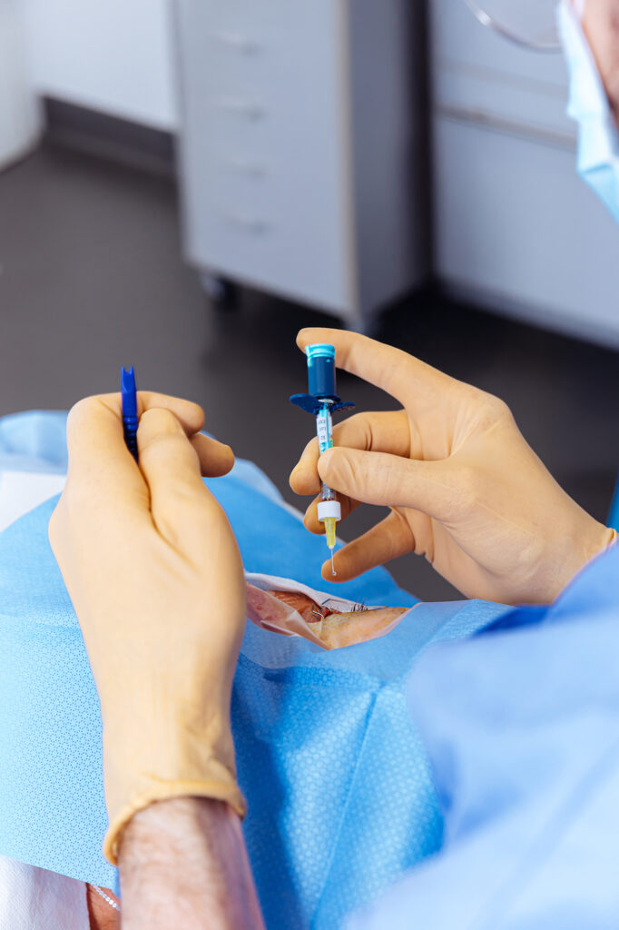 chirurgien réalisant une injection intravitréenne