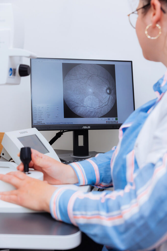 Appareil OCT (Optical Coherence Tomography) 